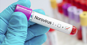 hay-mas-de-25-cepas-de-norovirus