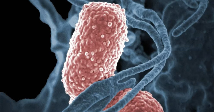 salmonella-y-shigella-sospecha-de-brote-de-origen-alimentario